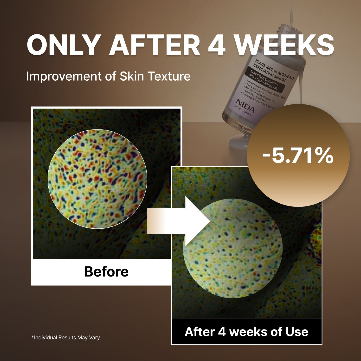 Paquete dúo de sueros exfoliantes blancos y negros NIDA