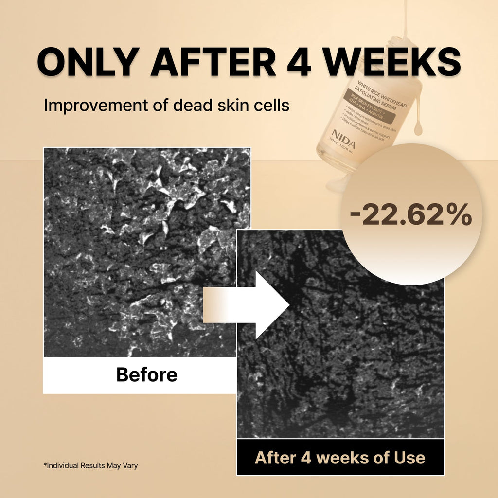 Paquete dúo de sueros exfoliantes blancos y negros NIDA