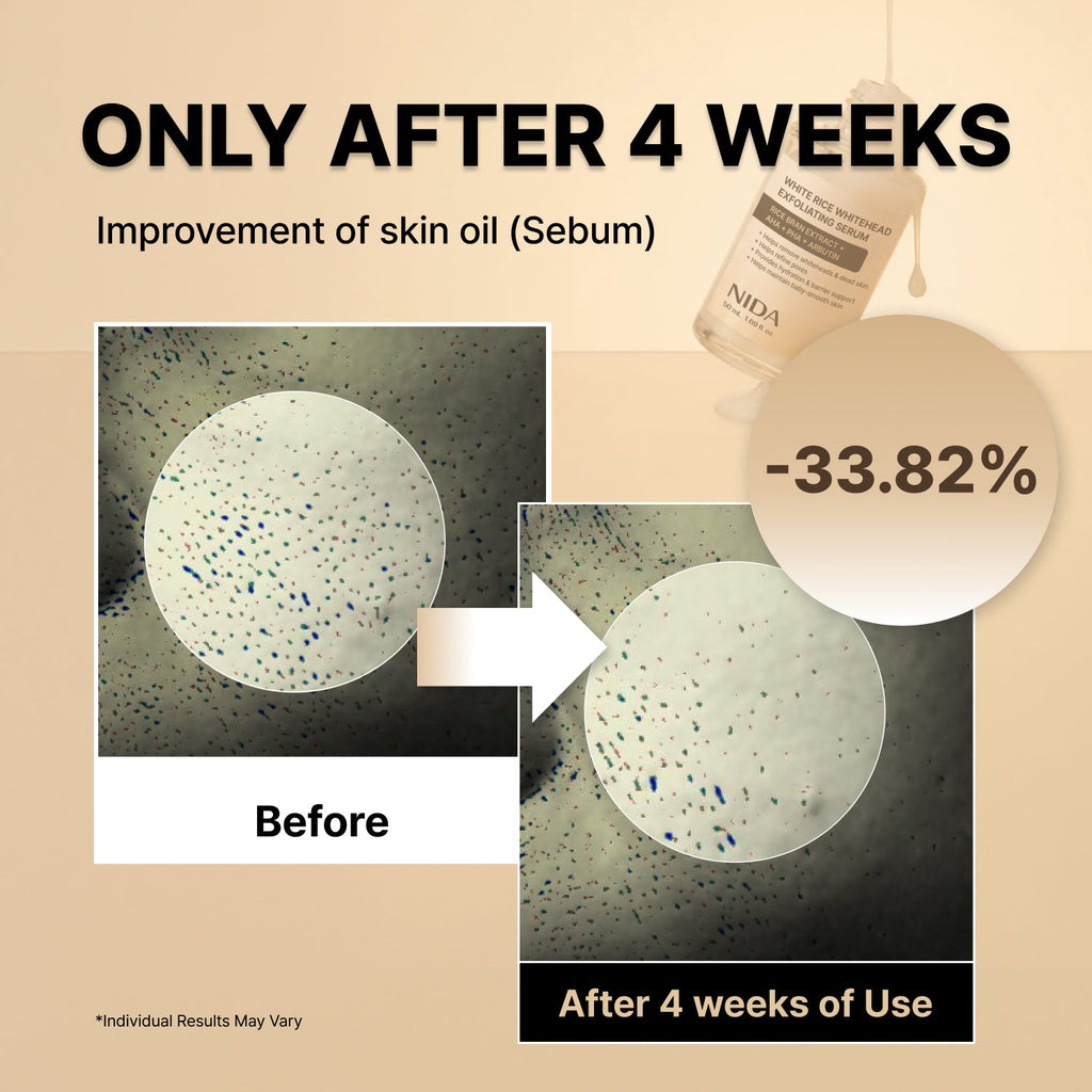 Paquete dúo de sueros exfoliantes blancos y negros NIDA